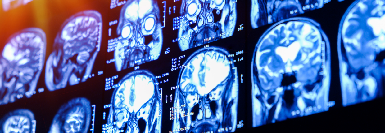 Комп’ютерна томографія | Lviv Medical Center | Львів Медікал Центр | ЛМЦ