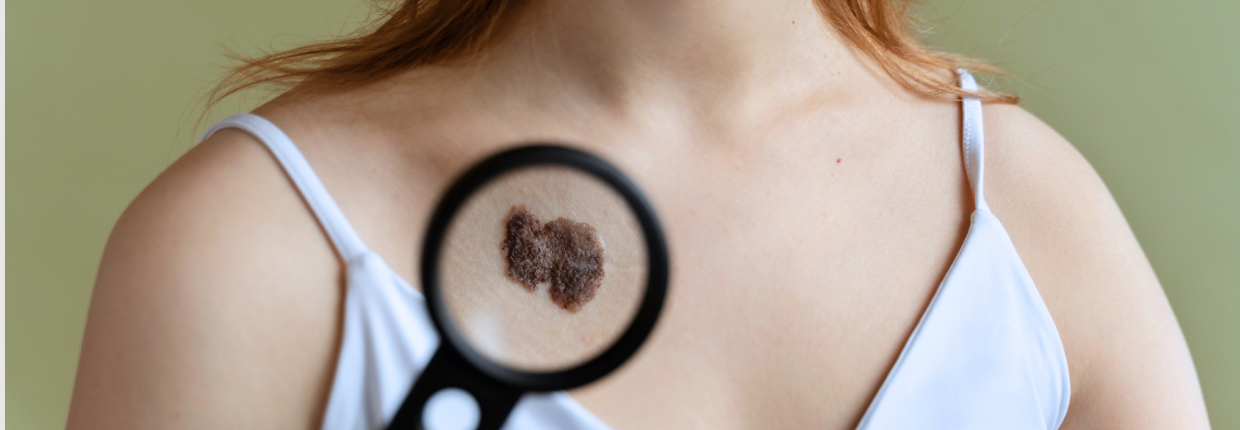 Дерматологія | Lviv Medical Center | Львів Медікал Центр | ЛМЦ