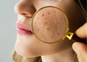 Дерматологія | Lviv Medical Center | Львів Медікал Центр | ЛМЦ