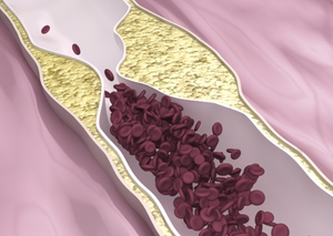 Судинна хірургія | Lviv Medical Center | Львів Медікал Центр | ЛМЦ