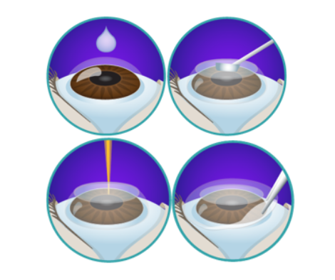 Лазерна корекція зору — ключовий напрямок діяльності клініки  Lviv Medical Center. | Lviv Medical Center | Львів Медікал Центр | ЛМЦ