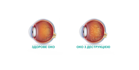 Вітреоретинальна хірургія | Lviv Medical Center | Львів Медікал Центр | ЛМЦ