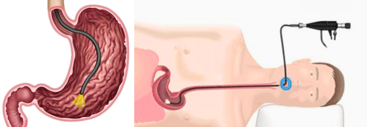 Гастроскопія | Lviv Medical Center | Львів Медікал Центр | ЛМЦ