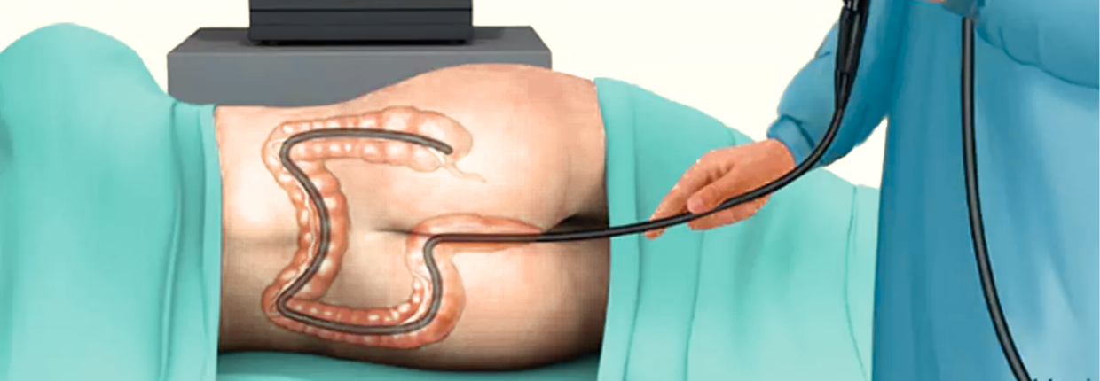 Колоноскопія | Lviv Medical Center | Львів Медікал Центр | ЛМЦ