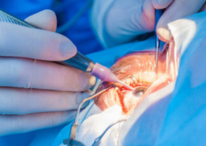 Вітреоретинальна хірургія | Lviv Medical Center | Львів Медікал Центр | ЛМЦ