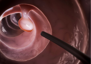 Колоноскопія | Lviv Medical Center | Львів Медікал Центр | ЛМЦ