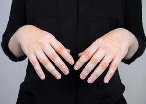 Ревматологія | Lviv Medical Center | Львів Медікал Центр | ЛМЦ