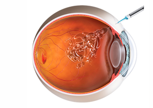 Фармакохірургія | Lviv Medical Center | Львів Медікал Центр | ЛМЦ