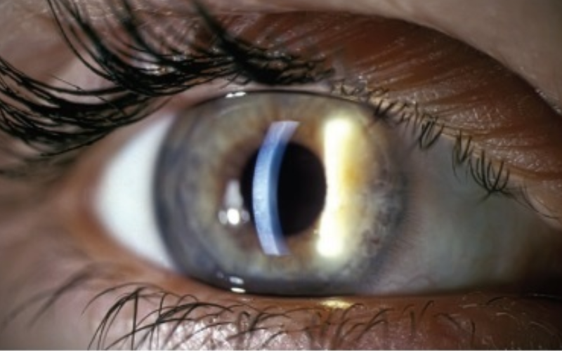 Діагностика зору | Lviv Medical Center | Львів Медікал Центр | ЛМЦ