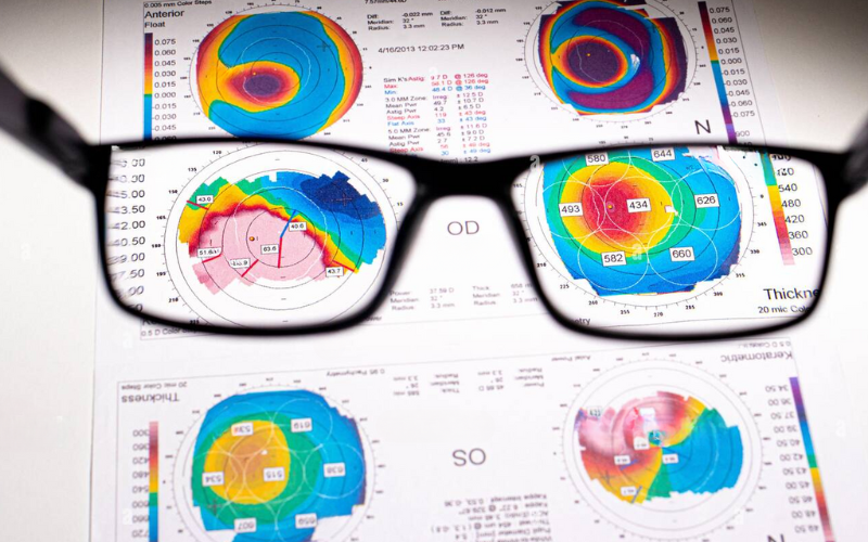 Діагностика зору | Lviv Medical Center | Львів Медікал Центр | ЛМЦ