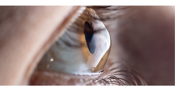 Лікування кератоконусу | Lviv Medical Center | Львів Медікал Центр | ЛМЦ