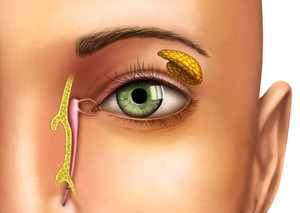 Інші операції переднього відрізку | Lviv Medical Center | Львів Медікал Центр | ЛМЦ