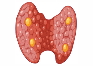 Ультразвукова діагностика | Lviv Medical Center | Львів Медікал Центр | ЛМЦ Ультразвукова діагностика | Lviv Medical Center | Львів Медікал Центр | ЛМЦ