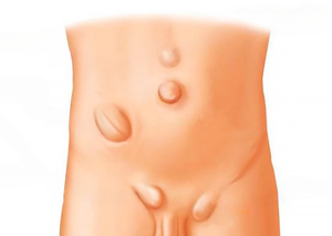 Ультразвукова діагностика | Lviv Medical Center | Львів Медікал Центр | ЛМЦ Ультразвукова діагностика | Lviv Medical Center | Львів Медікал Центр | ЛМЦ