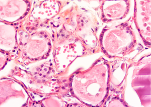 Лабораторні дослідження | Lviv Medical Center | Львів Медікал Центр | ЛМЦ