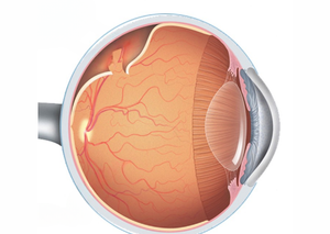 Вітреоретинальна хірургія | Lviv Medical Center | Львів Медікал Центр | ЛМЦ Вітреоретинальна хірургія | Lviv Medical Center | Львів Медікал Центр | ЛМЦ