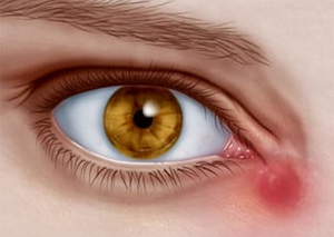 Інші операції переднього відрізку | Lviv Medical Center | Львів Медікал Центр | ЛМЦ