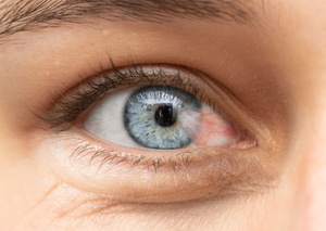 Інші операції переднього відрізку | Lviv Medical Center | Львів Медікал Центр | ЛМЦ