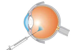 Фармакохірургія | Lviv Medical Center | Львів Медікал Центр | ЛМЦ