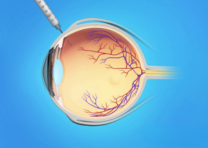 Фармакохірургія | Lviv Medical Center | Львів Медікал Центр | ЛМЦ