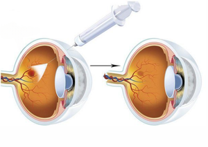 Фармакохірургія | Lviv Medical Center | Львів Медікал Центр | ЛМЦ