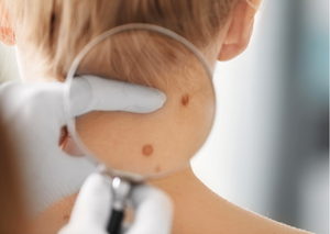 Дерматологія | Lviv Medical Center | Львів Медікал Центр | ЛМЦ