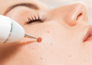 Дерматологія | Lviv Medical Center | Львів Медікал Центр | ЛМЦ