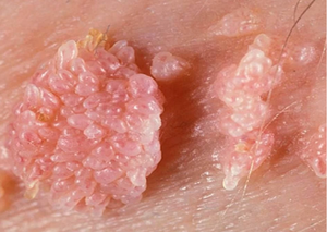 Дерматологія | Lviv Medical Center | Львів Медікал Центр | ЛМЦ