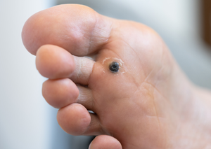 Дерматологія | Lviv Medical Center | Львів Медікал Центр | ЛМЦ