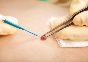 Дерматологія | Lviv Medical Center | Львів Медікал Центр | ЛМЦ